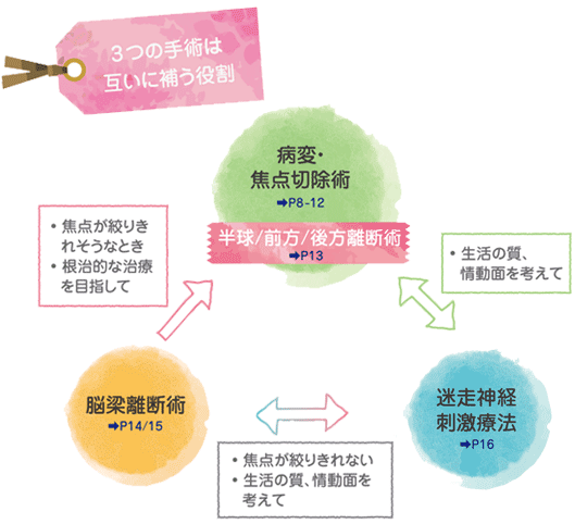 「3つの手術は互いに補う役割」病変・焦点切除術/脳梁離断術/迷走神経刺激療法